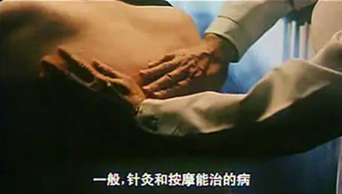 刮痧