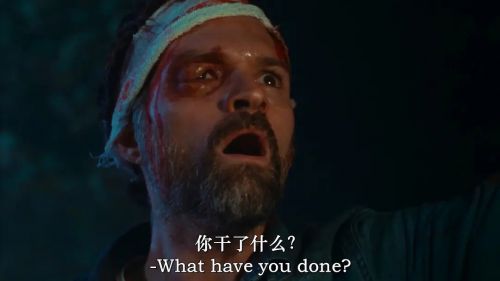 受伤的小鹿