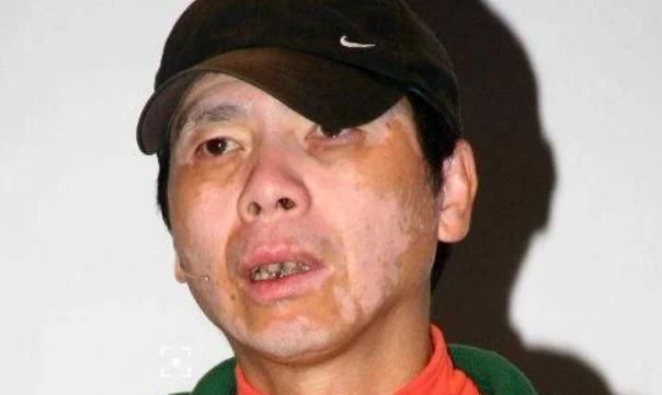 冯小刚再传病情恶化，身价20亿却放弃治疗？妻子徐帆无奈说出实情