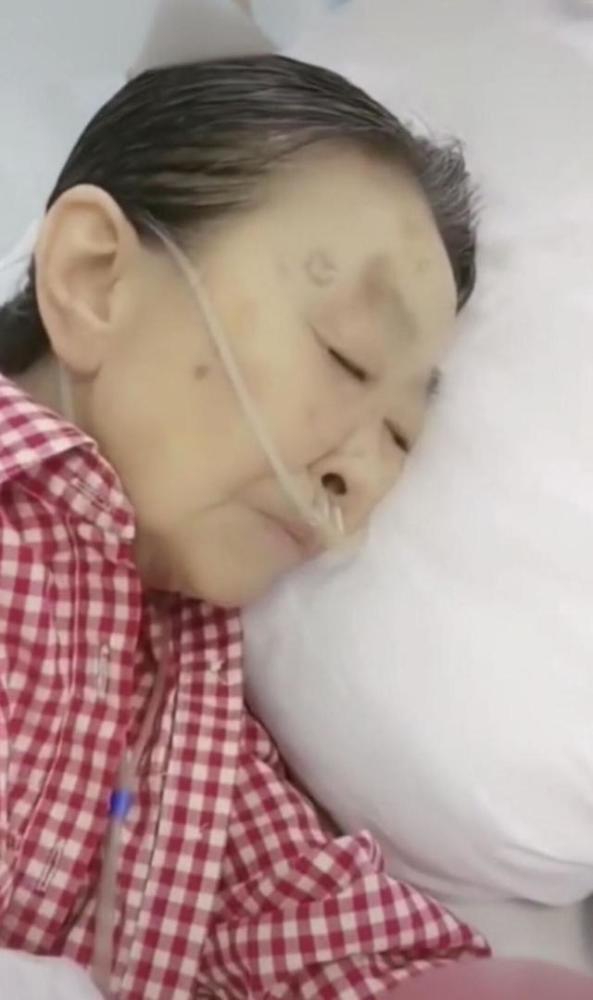 83岁张少华独自一人到医院看病，看起来十分憔悴，也很瘦弱