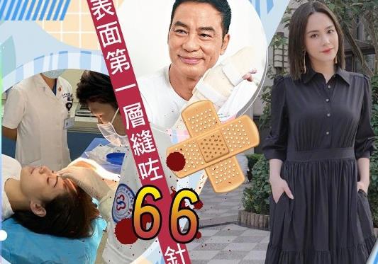 任达华介绍院长为阿娇手术：需缝几百针